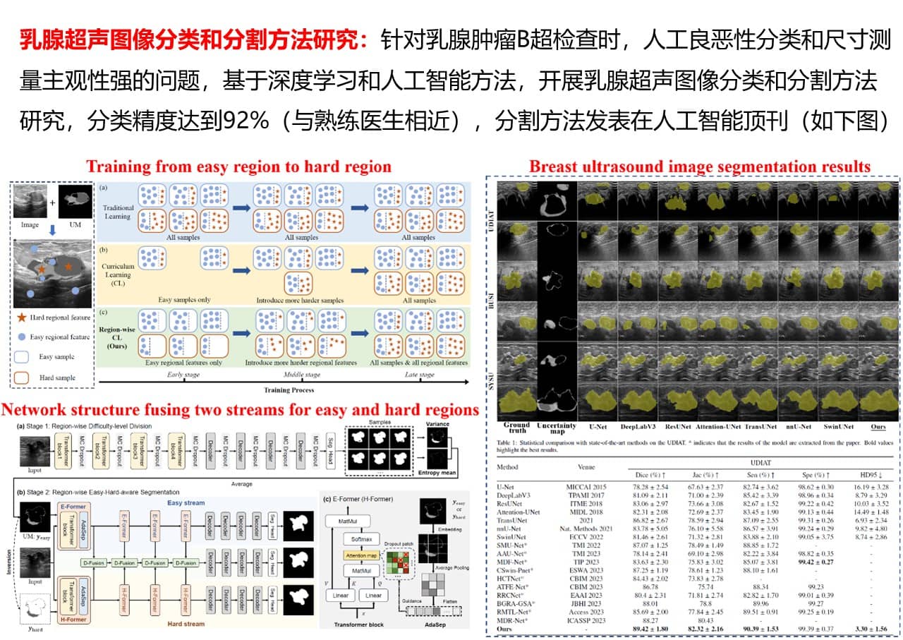 乳腺超声图像分类和分割方法研究.jpg