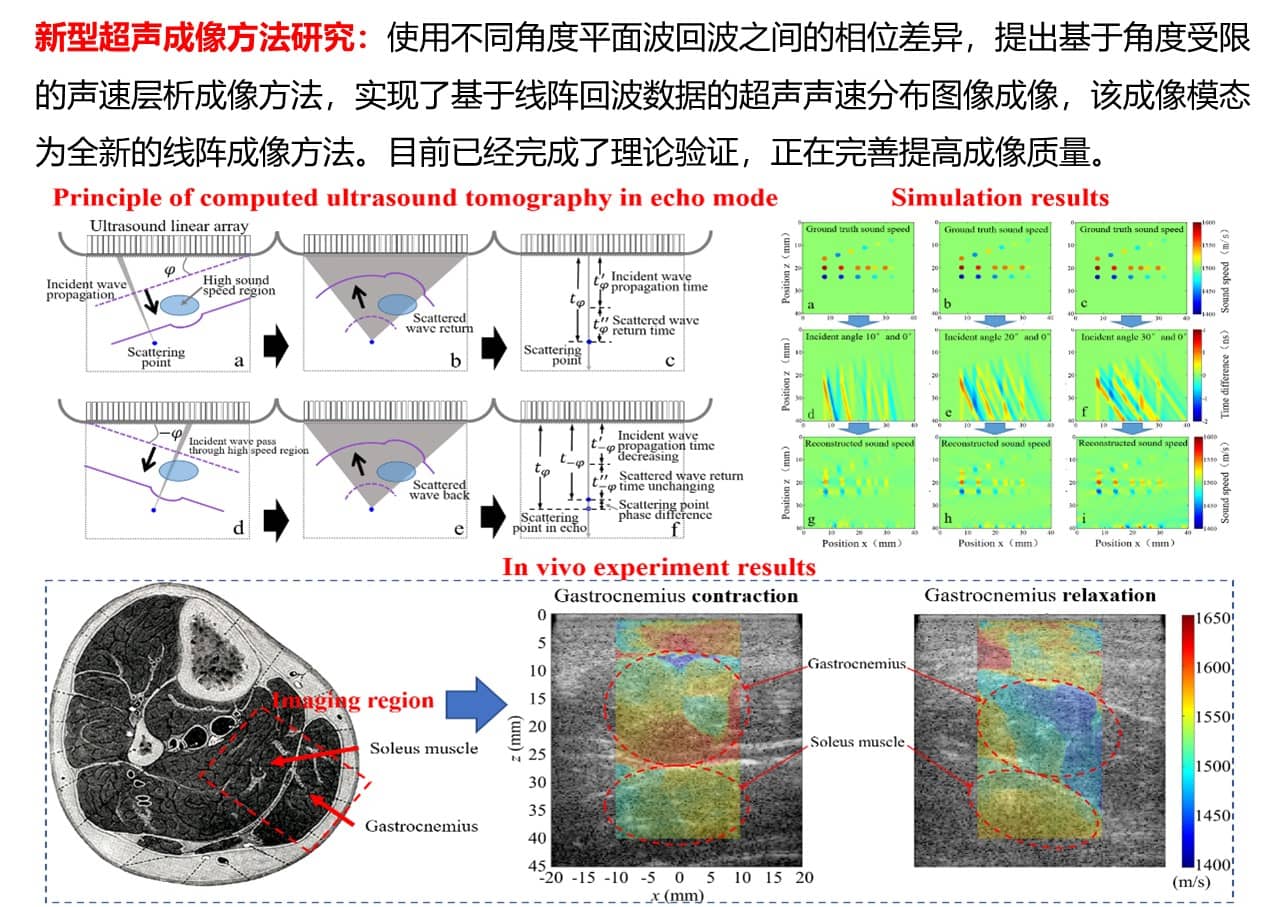 新型超声成像方法研究.jpg